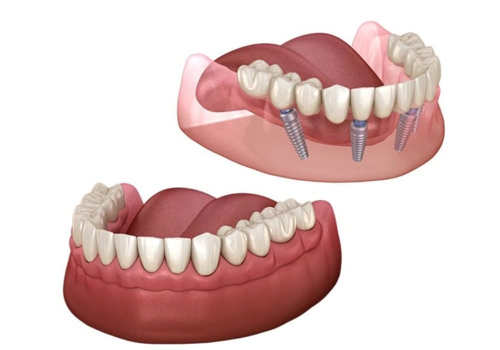 Bishnoi Dental Care